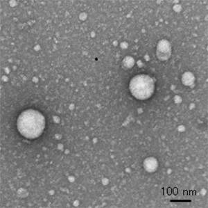 図１：血液から精製した細胞外小胞透過型電子顕微鏡にて撮影（5,000倍）